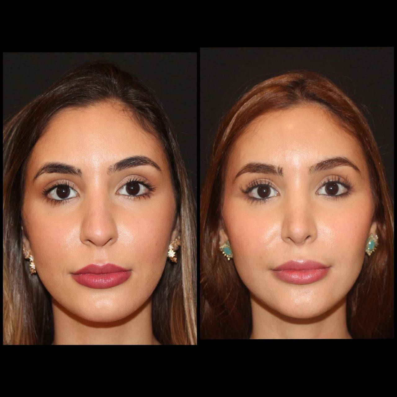 WhatsApp Image 2025-04-03 at 17.49.01